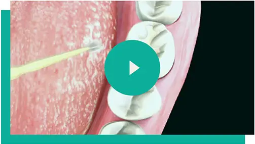 Teeth Treatment Video